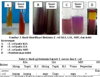 Gambar 3. Hasil Identifikasi Biokimia E. coli KIA, LIA, MIO, dan indol 