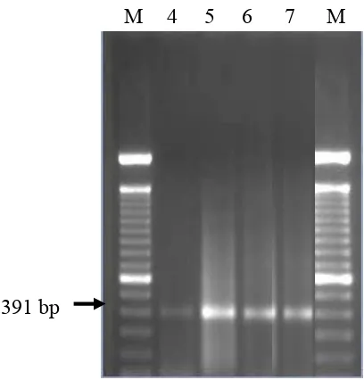 Gambar 3.3 Hasil amplifikasi DNA NSK dengan PCR   menggunakan primer 