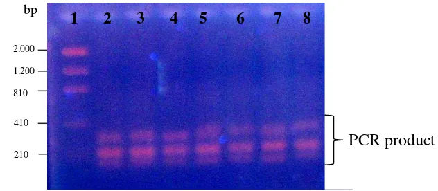 Figure 4 Multiplex PCR. Size marker: lane 1, samples: lane 2-8. 