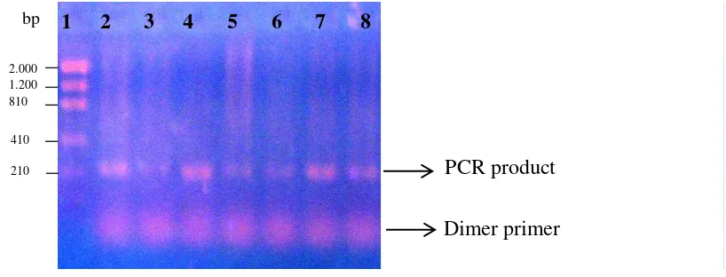 Figure 5 Single primer PCR. Size marker: lane 1, samples: lane 2-8.  