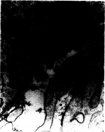 FIG. 1. An original EM image at 29,500~ magnification. lamina densa; 4, TAPM; lamina densa; 4, TAPM; FIG