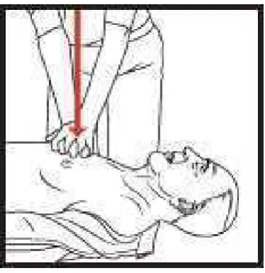 Gambar 1 Posisi tangan 