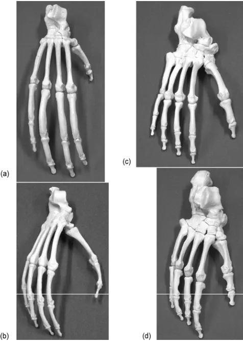 Figure 1. (a) The foot radiograph, (b) graph representation, and (c) foot skeleton.