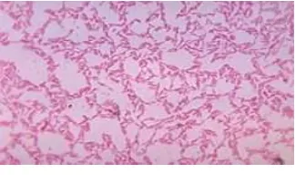 Gambar 8, :  Bifidobacterium adolescentis Gram.jpg (Sumber : Wikipedia, 2008c) 