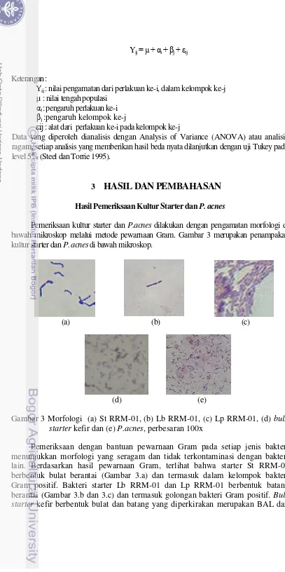 Gambar 3 Morfologi  (a) St RRM-01, (b) Lb RRM-01, (c) Lp RRM-01, (d) bulk 