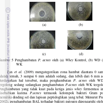 Gambar 5 Penghambatan P. acnes oleh (a) Whey Kontrol, (b) WD (c) WY (d) 