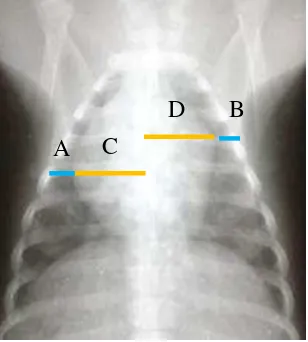 Gambar 4 Pengukuran radiografi jantung lapang pandang DV.  Keterangan: (A) nilai L, (B) nilai R, (C) nilai LH, (D) nilai RH