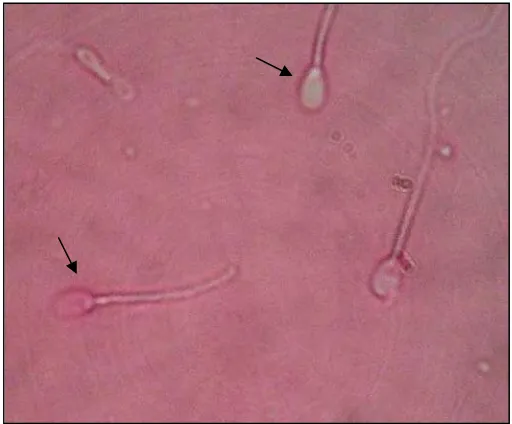 Gambar  5 Spermatozoa hidup (kepala putih) dan spermatozoa mati dengan (kepala        merah) dengan pewarnaan eosin-nigrosin 