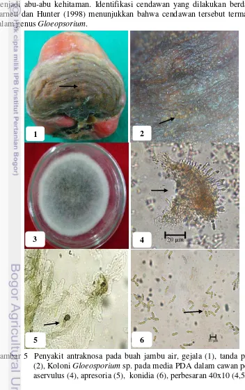 Gambar 5  Penyakit antraknosa pada buah jambu air, gejala (1), tanda penyakit (2), Koloni Gloeosporium sp