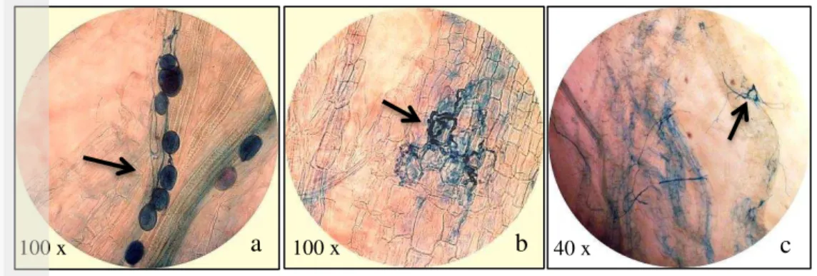 Gambar 6  Infeksi FMA pada semai balsa (a) vesikula, (b) arbuskula, dan (c) hifa 