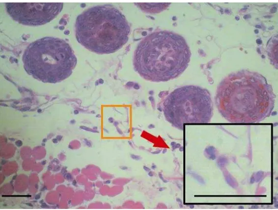 Gambar 10 Gambar sel radang neutrofil pada luka kelompok salep ekstrak pada 