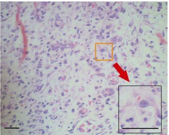 Gambar 12 Gambar sel radang makrofag pada luka kelompok salep eksrak pada hari ke-7 (Pewarnaan HE, Bar 40µm) 