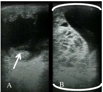 Gambar 9   Hasil USG (A) uterus kuda yang terdapat fetus dan (B) 