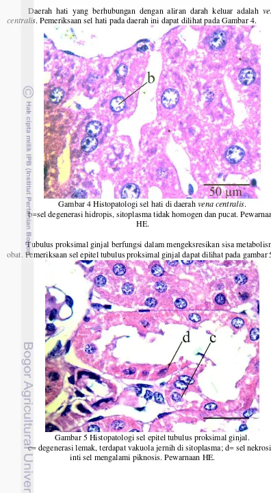 Gambar 4 Histopatologi sel hati di daerah vena centralis.  