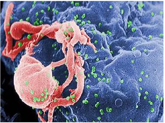 Gambar 2.3 Virus Penyebab HIV/AIDS 