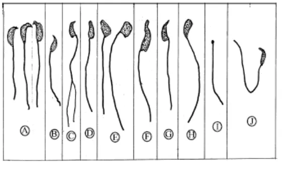Gambar 8. Morfologi Spermatozoa Mencit Normal dan Abnormal. (A) Spermatozoa normal; (B – J) Sperma abnormal