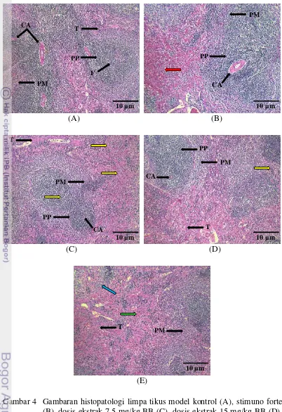 Gambar 4 Gambaran histopatologi limpa tikus model kontrol (A), stimuno forte (B), dosis ekstrak 7,5 mg/kg BB (C), dosis ekstrak 15 mg/kg BB (D), dosis ekstrak 30 mg/ kg BB (E)