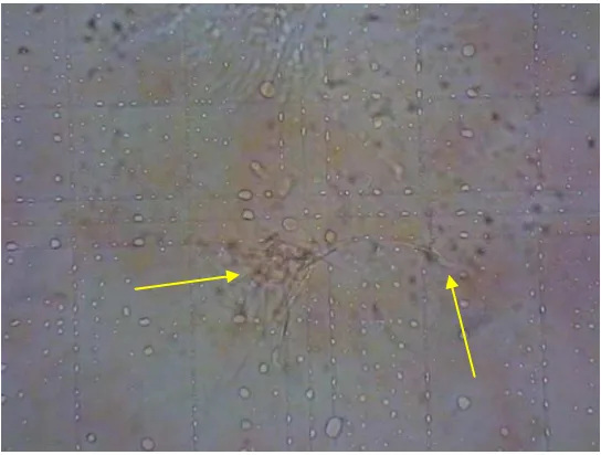 Gambar 4.2. Hitung Spermatozoa Kelompok K1 Dilihat dengan Perbesaran 400x 