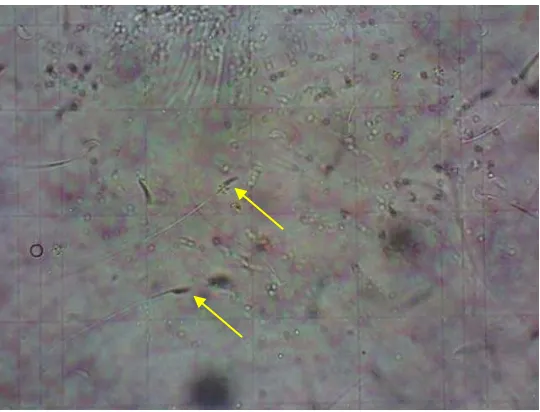 Gambar 4.5. Hitung Spermatozoa Kelompok K4 Dilihat dengan Perbesaran 400x 