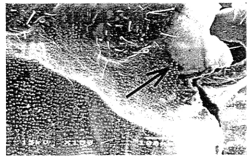 Gambar 4. Selaput tipis khitin rayap C.curvig~zatlzus yang telah mengkonsumsi umpan hexaflu~nuson 