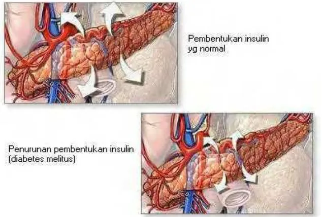 Gambar Produksi Insulin (Medicastore  2004)