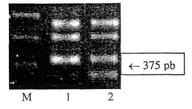 Gambar 1. DNA kelapa hasil amplifikasi PCR yang dielektroforesis pada gel agarose. M adalah penanda DNA I kb ladder