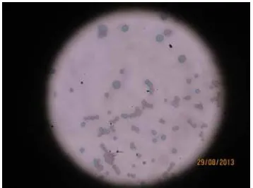 Tabel 4. Hasil uji sensitivitas bakteri Staphylococcus aureus Standar diameter zona hambat Hasil 
