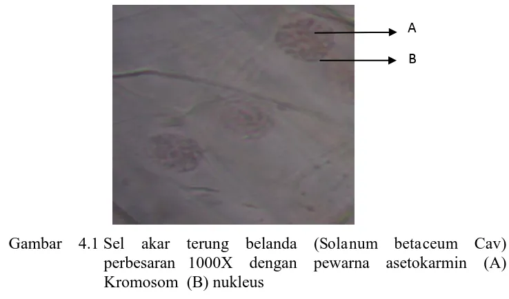 Gambar 4.1 Sel akar terung belanda (Solanum betaceum Cav)                                    perbesaran   1000X dengan pewarna asetokarmin (A) 