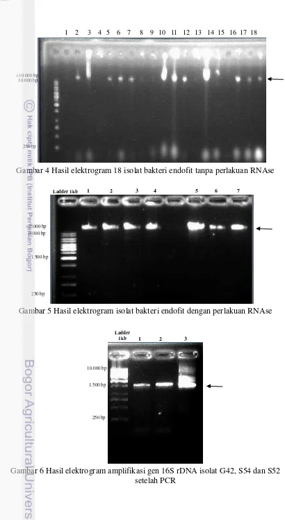Gambar 5 Hasil elektrogram isolat bakteri endofit dengan perlakuan RNAse 