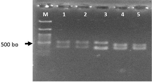 Gambar 7. Panjang IGS LactobacillusPediococcus sp F213 (1, 2), L. rhamnosus SKG34 (3) dan  spp (4,5)  