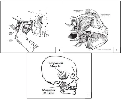 Gambar 5. Otot (a) Otot pterigoid 38 (b) Otot Masseter 38 (c) Otot Temporalis 36 