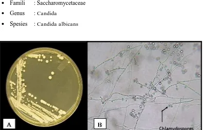Gambar 7. Candida albicans (A)yang ditanam dalam 