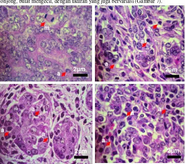 Gambar 7.   Bentuk sel-sel tumor kelenjar mamari mencit C3H yang mengalamimitosis dan apoptosis dengan perbesaran 400x