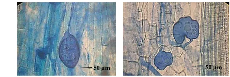 Gambar 3 Tipologi hifa Glomus etunicatum (kiri) dan Aacaulospora tuber-culata (kanan) (400x, 1 bar = 50 µm) 