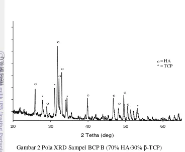 Gambar 2 Pola XRD Sampel BCP B (70% HA/30% β-TCP) 
