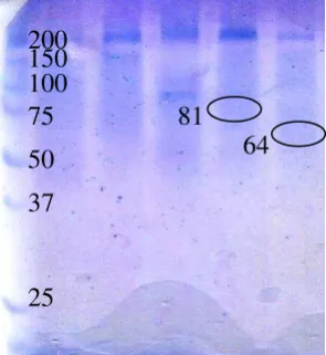 Gambar 1 Hasil elektroforesis 