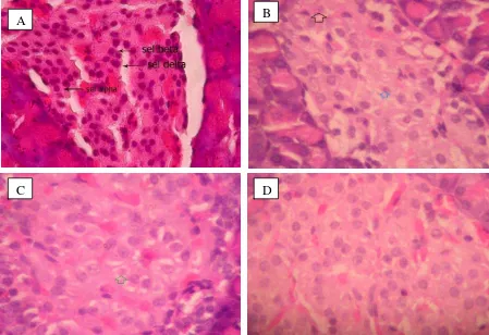 Gambar 7. Histologi pankreas tikus kelompok PS negatif (A), PS positif (B),  