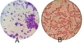 Gambar 2.  Hasil pengecatan bakteri S.  aureus (A) dan P.  aeruginosa (B) 