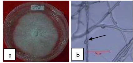 Gambar 5  Morfologi G. boninense: (a) makroskopi, (b) clamp connection 