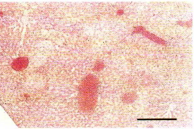 Gambar 2.  Hati kemerahan pada RabbitFish Siganus canaliculatus        yang terinfeksi    S