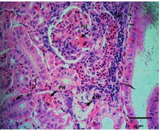 Gambar 25.    Glomerulus (GR) mengalami peradangan (R) dan atrofi (AG), Sel epitel tubulus membengkak mengalami degenerasi (DT)