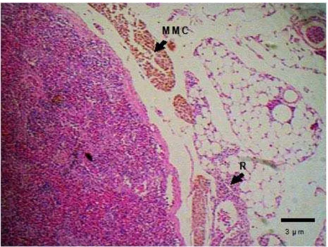 Gambar 34.  Peritonitis yang diindikasikan dengan sel radang dan MMC pada bagian serosa (R)