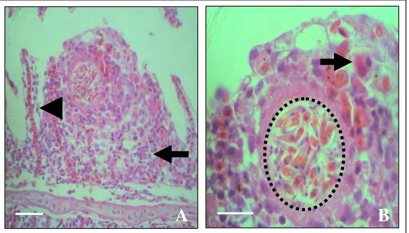 Gambar 5 Hiperplasia dan fusi lamela sekunder (Panah A). Edema epitel lamela sekunder 