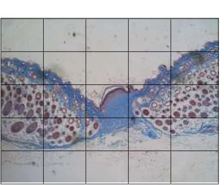 Gambar� 7.� Metode� penentuan� luas� kolagen� dan� reepitelisasi� pada� pengamatan����histopatologi� jaringan� luka.� Pada� tampilan� gambar� videomicrometer��dibuat�pola�kotak,kotak�yang�tiap�sisi�kotaknya�berukuran�200�m��