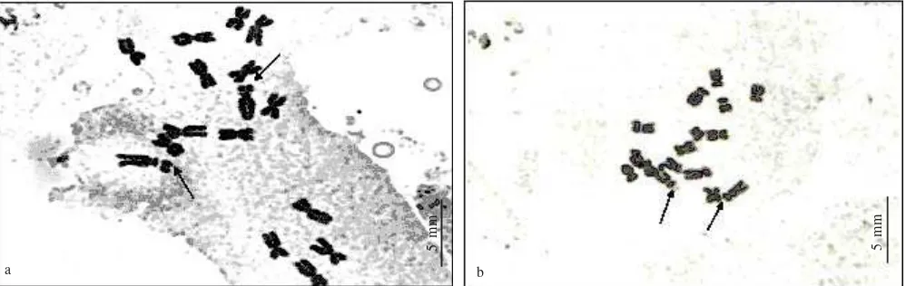 Figure 1. Mitotic metaphase chromosomes of S. japonica from Ichinomiya, Kaibara-cho, Hyogo Pref (J34) 2n = 16 (a), and S