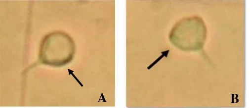 Gambar 2 Ciri-ciri sel sperma normal (A) dan sel sperma abnormal (B) udangvaname.