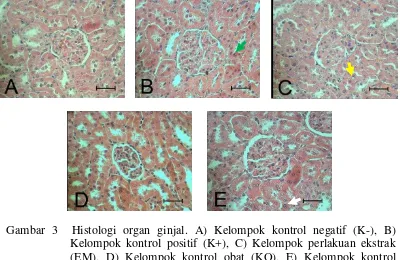 Gambar 3  Histologi organ ginjal. A) Kelompok kontrol negatif (K-), B) 