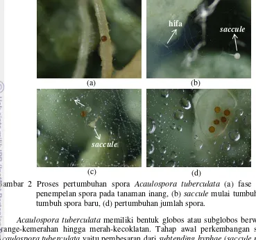 Gambar 2 Proses pertumbuhan spora Acaulospora tuberculata (a) fase awal 