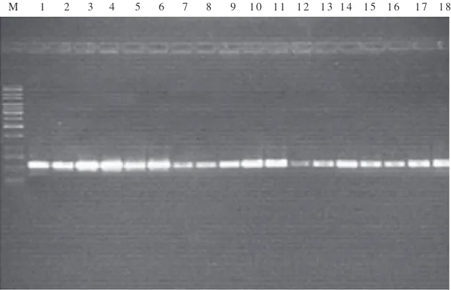Fig 1  Detection of mxaF genes of PPFM isolates: M 1 kb DNA Ladder; well 1-10, isolates (WD1-WD10); well 11-14, isolates (WK1-WK4); well 15-16, isolates from potable water supply (TA1-TA2); well 17-18, isolates from bathrooms (KM1-KM2).