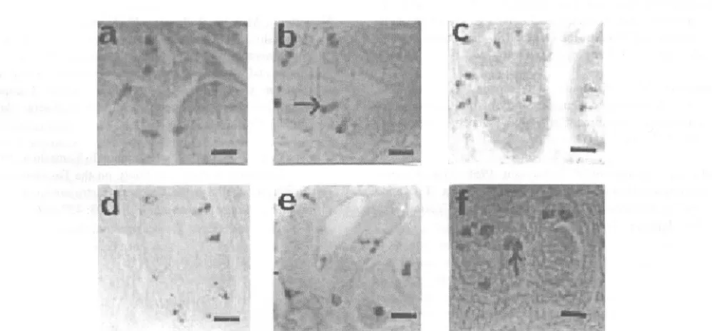 Gambar 2. Gambaran sel-sel endokrin pada proventrikulus (a) dan ventrikulus (b). penyebaran sel-sel endokrin pada pro-ventrikulus berlokasi di daerah kelenjar multilobuler di daerah lamina propria sedangkan pada ventrikulus sedikit sel endo-krin di daerah 